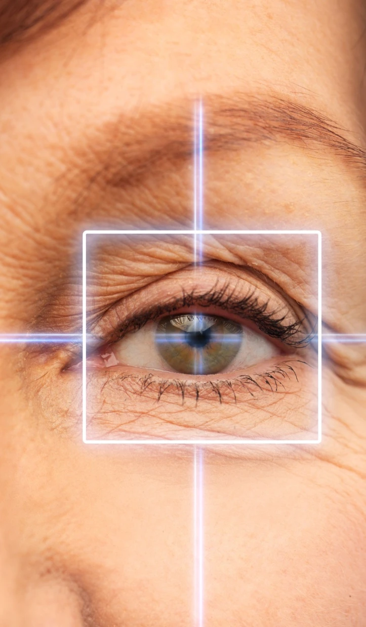 close up of laser eye surgery on senior person