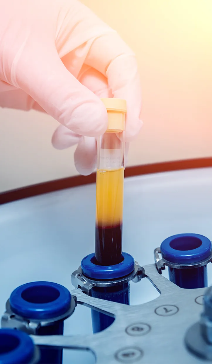 doctor holding serum tube being extracted with centrifuge