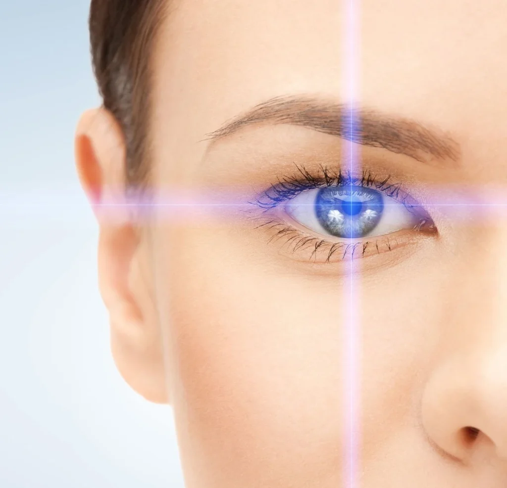 representation of laser eye surgery