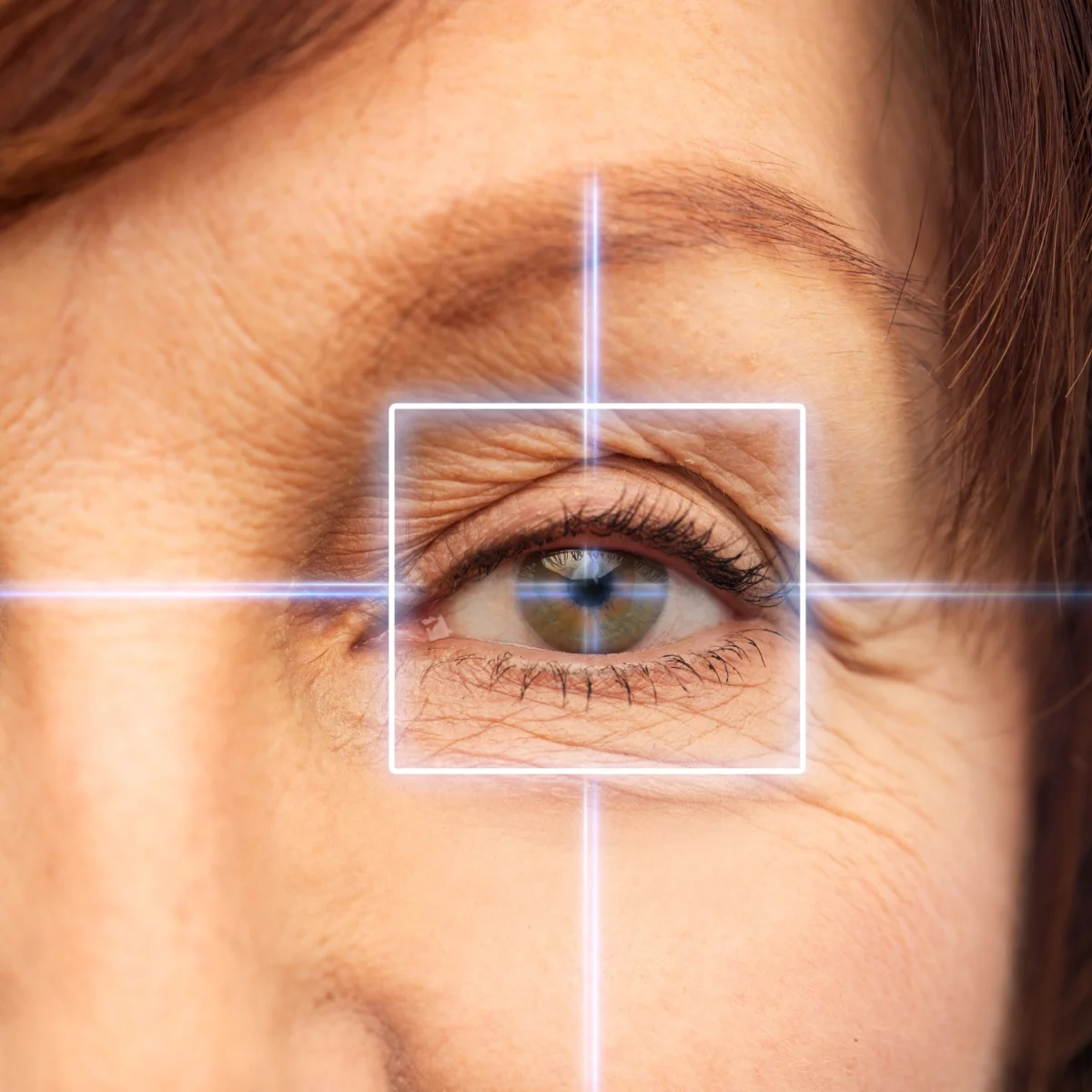 senior eye close up for surgical treatment