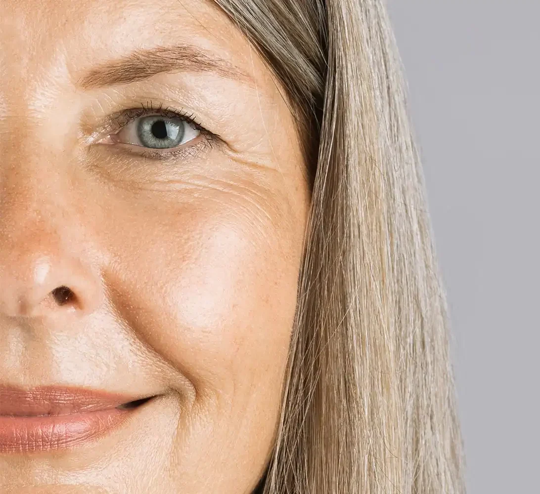 woman with ptosis up close