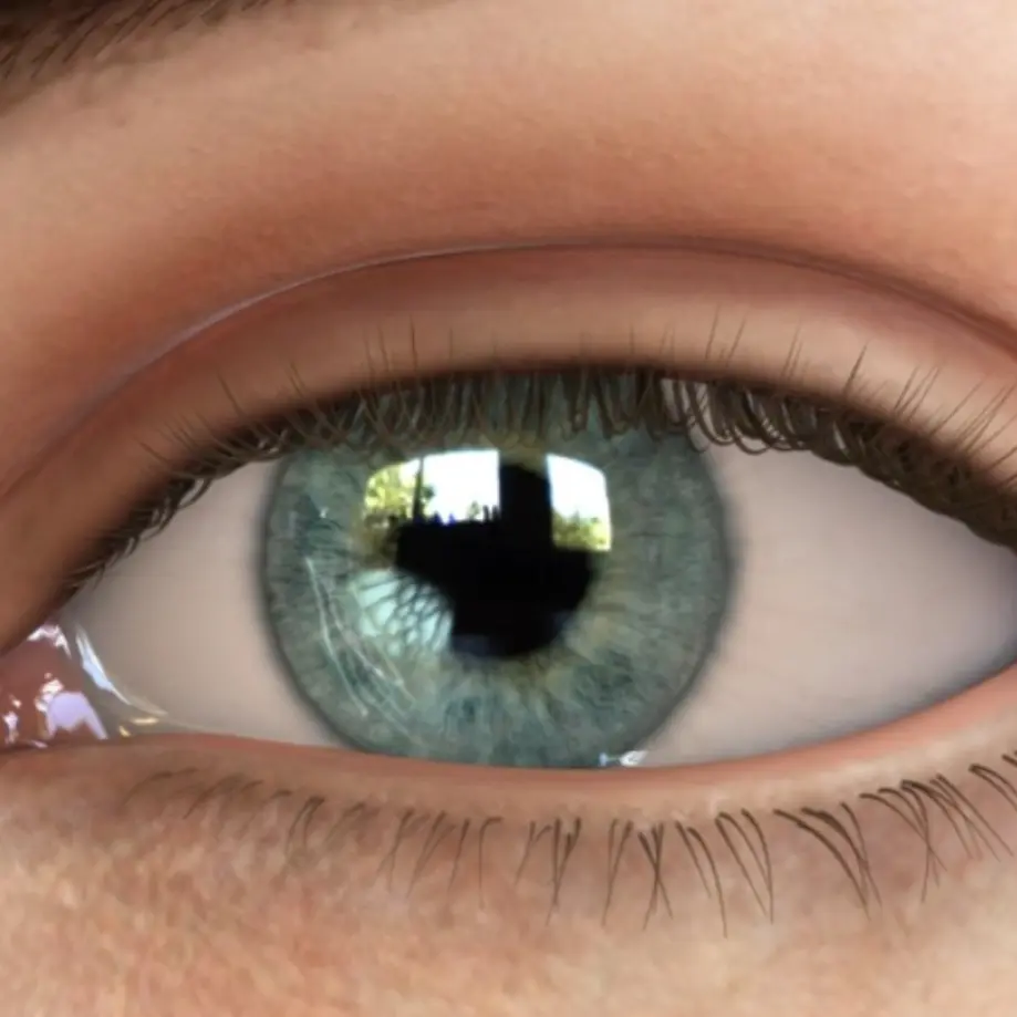 Corneal abrasion video